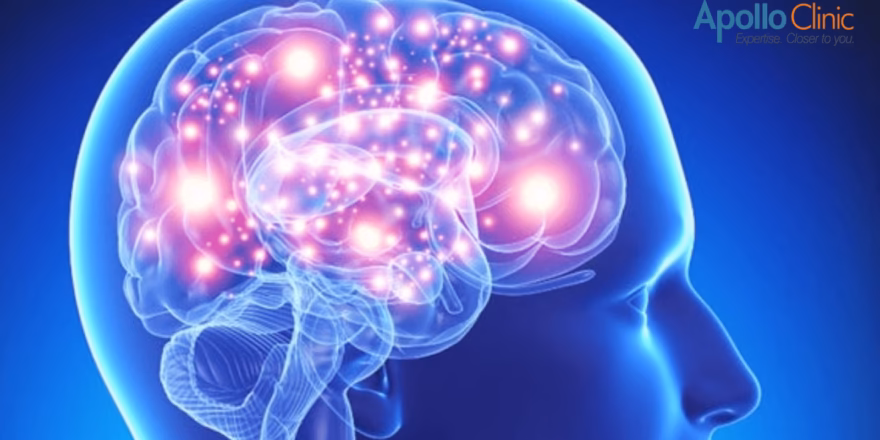 Alzheimer’s disease
