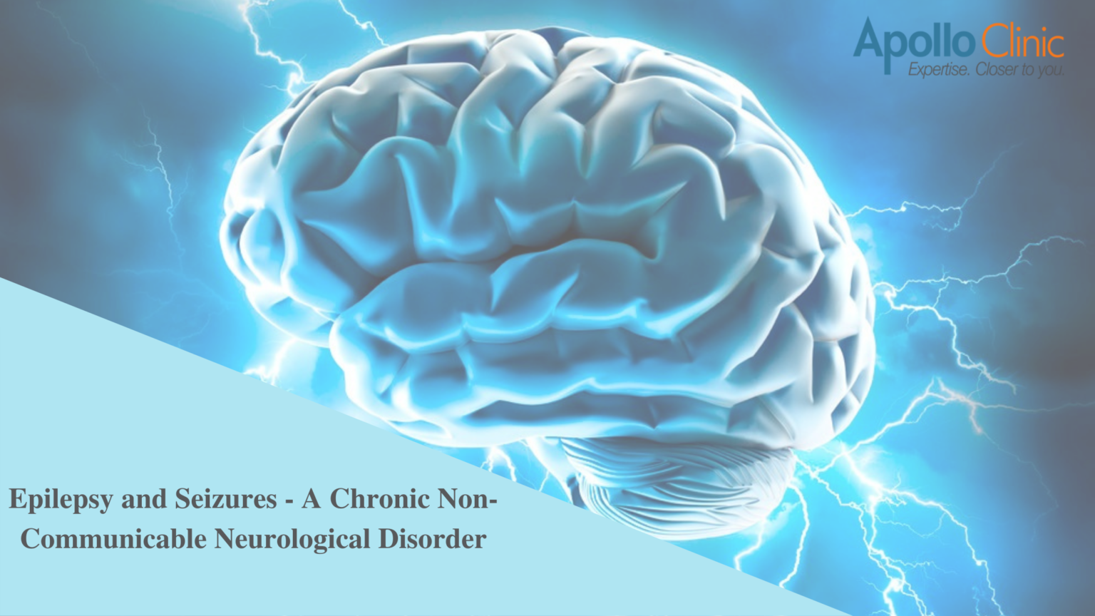 Epilepsy And Seizures -A Chronic Neurological Disorder