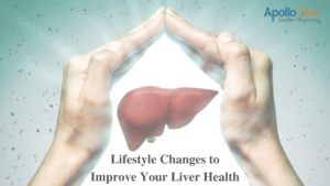 Read more about the article How to improve liver health ?