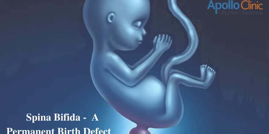 Spina Bifida A Permanent Birth Defect