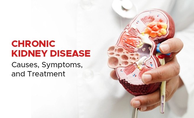 Explore the causes, symptoms, and treatment options for Chronic Kidney Disease.