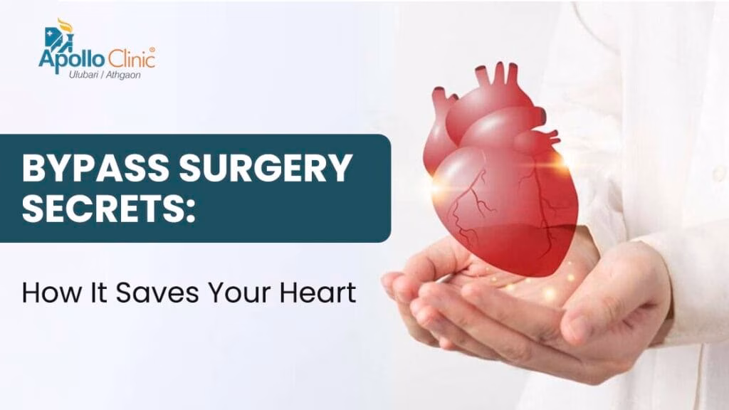 Bypass surgery secrets revealed! Learn how it transforms heart health, aids recovery, and sets you on the path to a better life.