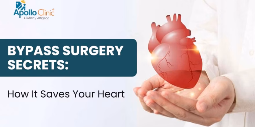 Bypass surgery secrets revealed! Learn how it transforms heart health, aids recovery, and sets you on the path to a better life.