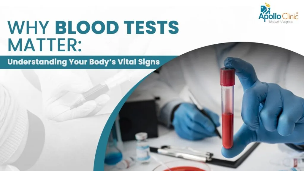Blood tests are powerful tools for assessing health. Learn how they detect diseases, monitor vital signs, and help you make informed wellness choices.