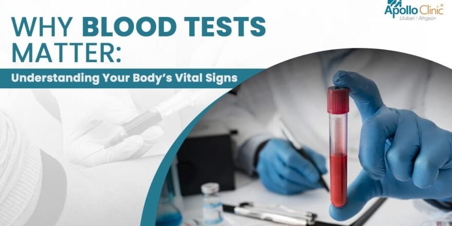Blood tests are powerful tools for assessing health. Learn how they detect diseases, monitor vital signs, and help you make informed wellness choices.