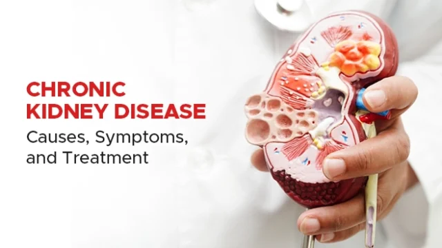 Explore the causes, symptoms, and treatment options for Chronic Kidney Disease.