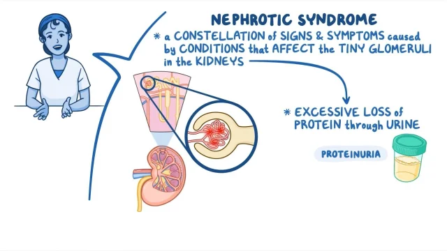 Understand nephrotic syndrome: causes, symptoms, treatments. Learn more!