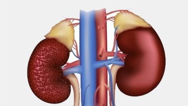 Diabetic Nephropathy